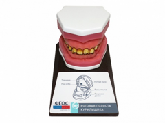 Демонстрационная модель "Ротовая полость курильщика" - fgospostavki.ru - Нижневартовск